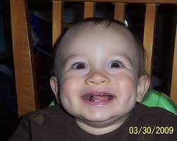 Snapz: Toothless Grins Photo Gallery