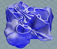Sinus surgery can improve or correct some sinus conditions. Nasal Cavity With Paranasal Sinuses Other Organs Embodi3d Com
