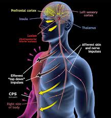 Image result for Pain Disorder