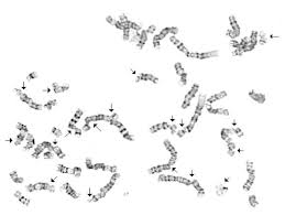 An picture of the chromosomes found in an individual's cells and arranged in pairs and in order of diminishing size. Chromosome Instability Springerlink