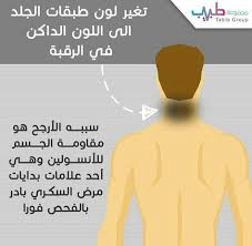 Pin By امون On غذاء ودواء Food And Medicine Health Health Fitness Face Hair