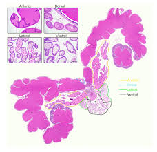أيّ طرق عملية البروستاتا موجودة؟ Identification Histological Characterization And Dissection Of Mouse Prostate Lobes For In Vitro 3d Spheroid Culture Models Protocol