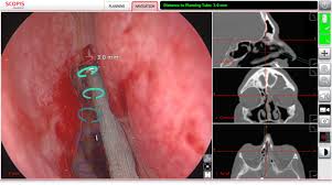 Our specialists use advanced surgical. Rhinology Simulation Training Part 1 Springerlink
