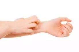 Maybe you would like to learn more about one of these? What To Do With Eczema Teach You A Quick Way To Stop Itching Sihai Network Amp