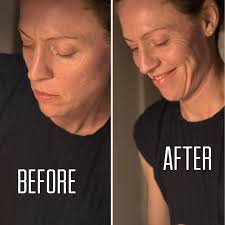 𝑴𝒂𝒓𝒕𝒂 𝑶'𝑪𝒐𝒏𝒏𝒐𝒓 𝐒𝐤𝐢𝐧𝐜𝐚𝐫𝐞 𝐒𝐭𝐮𝐝𝐢𝐨