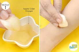More reasons apple cider vinegar benefits health let it sit overnight and your cooler will be fresh and clean. How To Get Rid Of Ringworm Kill The Infection With Home Remedies