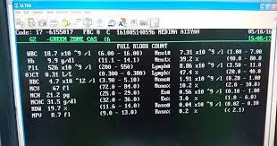 Kisah anak asik demam on off je ni. Dya Mohamad Kisah Anak Demam On Off