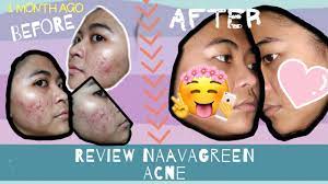 We did not find results for: Skincare Untuk Kulit Berjerawat Review Naavagreen Pemakaian 1 Bulan Youtube