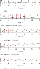 measurement 2 ecg and blood flow pulsation responses in