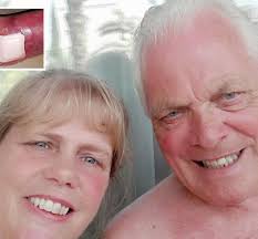 Holidaymaker had his toe AMPUTATED after catching an infection