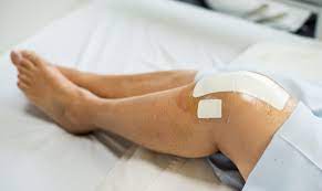 The healing process takes time and the one of the biggest determinants of successful patient outcome after knee replacement surgery is the. 5 Tips To Speed Your Recovery After Knee Replacement Surgery Apurva Dalal Md Faaos Orthopaedic Specialist