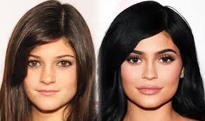 Kylie jenner has made over a million sales of her signatures entitled 'kylie lip kit' besides being named the most. Kylie Jenner 2017 Has Kardashian S Half Sister Said To Be Pregnant Had Plastic Surgery Express Co Uk