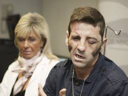 El torero Juan José Padilla sufre una gravísima cornada en la cara en  Zaragoza