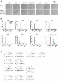 Download the infected rar torrent for free, direct downloads via magnet link and free movies online to watch also available, hash : The Rna Sensor Mda5 Detects Sars Cov 2 Infection Biorxiv