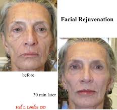 Aging right. But I still got the face