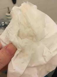 Yes, it is normal to have more vaginal discharge while pregnant. Mucus Discharge At 38 Weeks Pregnant