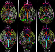 They also take waste and carbon dioxide away from the tissues. Automatic Anatomical Labeling Of The Complete Cerebral Vasculature In Mouse Models Sciencedirect
