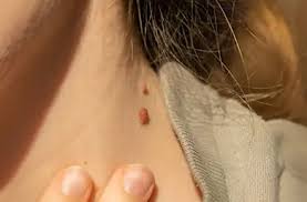 Russel Alfred Bucher