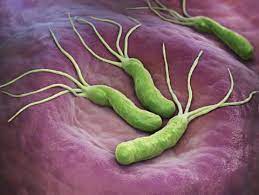 Magenkrebsrisiko Durch Helicobacter Pylori Dr Scharf Wien