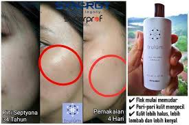 We did not find results for: Trulum Synergy Skincare Reviews Facebook