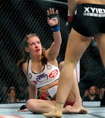 Craig landed a series of strikes and the referee stopped it due to the arm. Weidman Defends Ufc Belt When Silva Injures Leg Honolulu Star Advertiser
