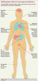 Dialysis Catheter In 2020 End Stage Renal Disease Renal Disease Acute Kidney Injury