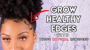 Great tips for natural hair, relaxed hair and transitioning hair. Thicken Up Them Edges Grow Your Edges Back W These Natural Remedies Youtube