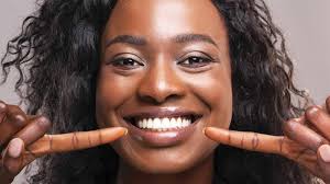 Win A Smile Makeover Worth £15,000!