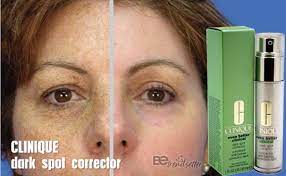Plus, unlike most intense corrective treatments, this one is gentle and works with all types of skin—no matter how sensitive. Skin Dark Spot Removal To Get Rid Of Age Spots