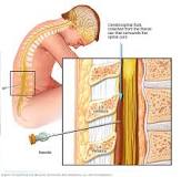 Image result for what is naegleria fowleri including symptoms and treatment?