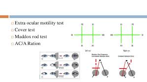 Examination Protocol For Binocular Vision