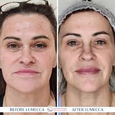 Broome Nurse Practitioners Skincare