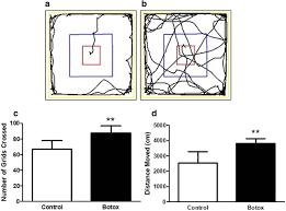 May 21, 2015 · how long does botox® last? Intramuscular Injection Of Botox Boosts Learning And Memory In Adult Mice In Association With Enriched Circulation Of Platelets And Enhanced Density Of Pyramidal Neurons In The Hippocampus Springerlink