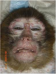 You should probably pay attention to this. Why Is Monkeypox Called Monkeypox