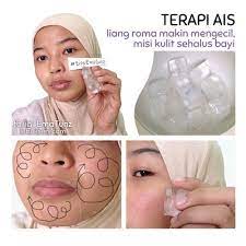 Cara menghilangkannya adalah dengan kompres air es, kompres kantung teh, krim wajah, hingga tindakan medis tertentu. Hilangkan Lingkaran Gelap Bawah Mata Guna Sudu Sejuk