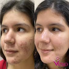 Empezamos la semana con uno de mis...