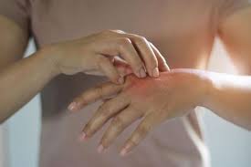 Calamine mengandung campuran oksida seng dan oksida besi yang biasa digunakan untuk menghilangkan rasa sakit dan. 9 Cara Ampuh Mengatasi Iritasi Kulit