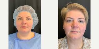 Mark H. Tseng, MD, Physician