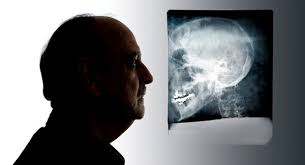 FRONT AND CENTER: Patrick Moore