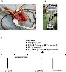 It is a device that does the work of providing blood (and oxygen) to the body when the heart is stopped for a surgical procedure. A Rabbit Model Of Cardiopulmonary Bypass Coagulopathy A Cannulas In Download Scientific Diagram
