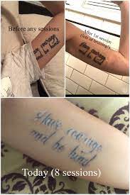 Im interested in tattoo removal.i dont want to spend a boat load of money on it tho.it seems you pay for each session so i was just wondering how many sessions you think this tattoo i have would take so i can estimate how much id have to spend.i have a star on left hand of my lower stomach. My Tattoo Removal Progress With Picosure Laser Tattooremoval