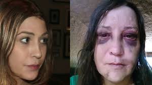 Fundraiser for lauren avery by Rachel Keyte : Helping Lauren's Healing  Process