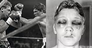 Schattenboxer Teil 6: Billy Collins Junior