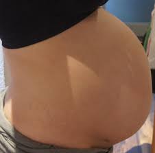 35 Ssw Harter Bauch