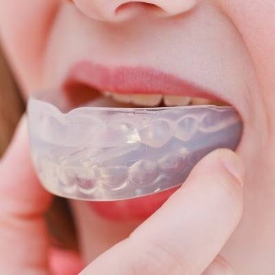 Best Mouthguard For Grinding Teeth In Dubai & Abu Dhabi | Cost