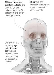 What causes head pressure and brain fog? Could My Symptoms Be Covid 19 The New York Times