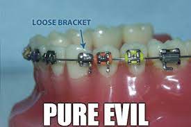 12 Problems Only People Who Had Braces Will Understand The Daily Edge