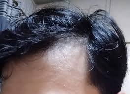 Don't forget the styles that style the hair back from the forehead. Hi Reddit Does This Look Like A Receding Hairline Im Only 17 Imgur