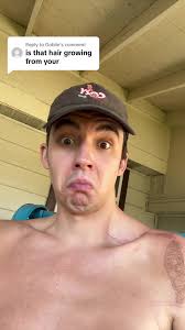 Replying to @Goblin hairy situation i got here #hair #shoulder #scar ...