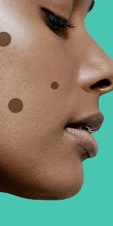 What should i do if i have red spots on my face? 9 Dark Spot Treatments That Really Work According To Dermatologists Self